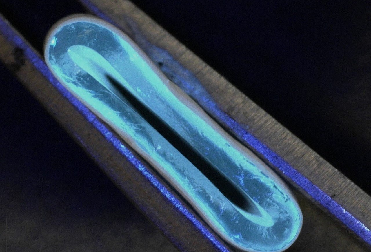 Artificial blood vessels could improve heart bypass outcomes