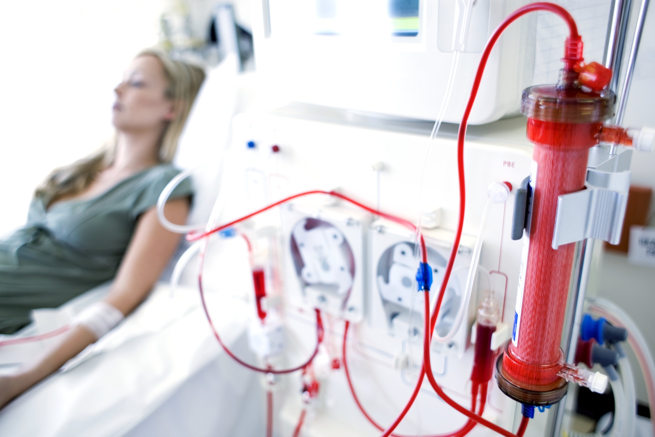 Invizius awarded major funding to bring dialysis treatment to clinic