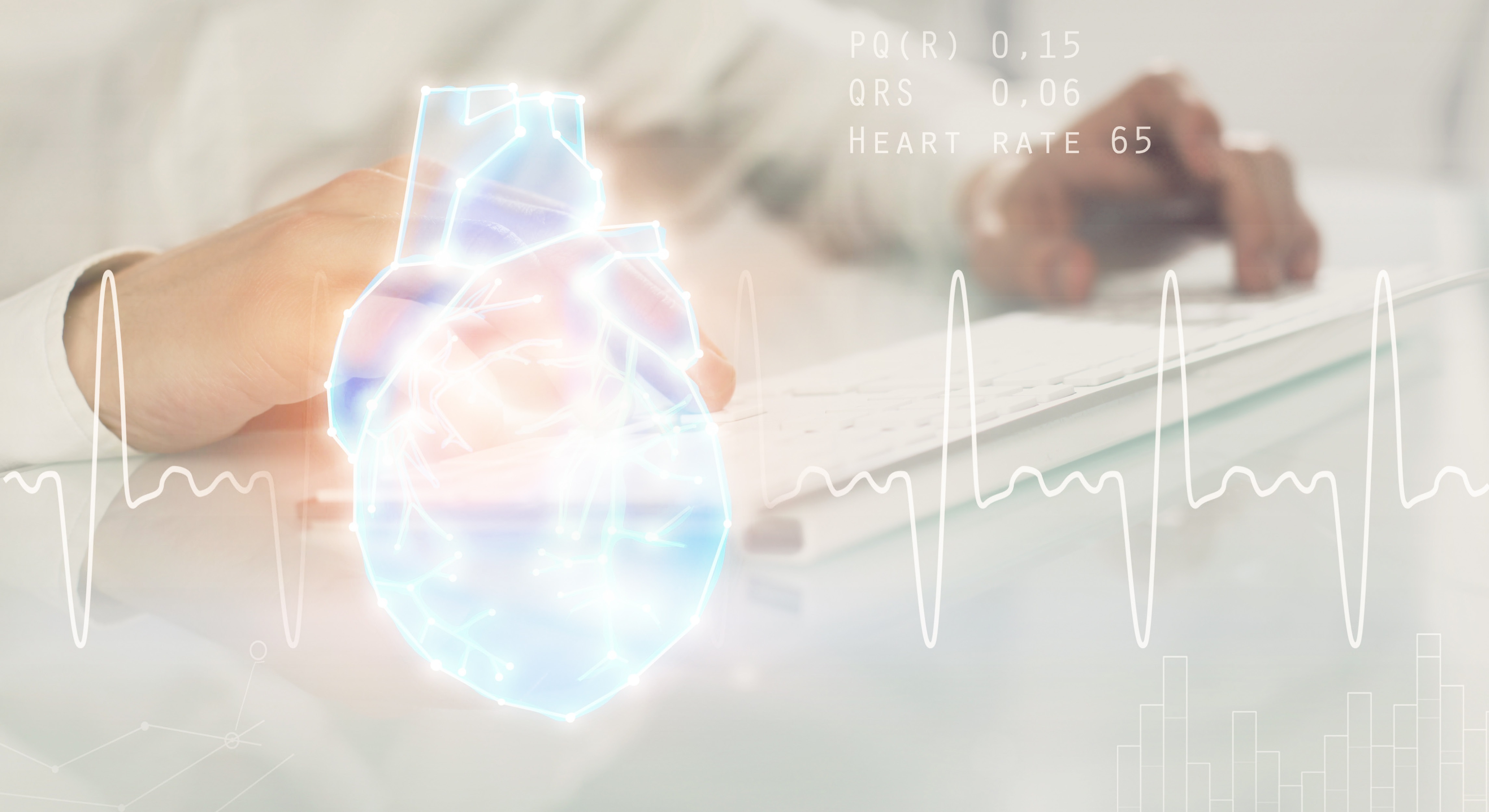 AI in heart attack diagnosis could reduce pressure on emergency departments