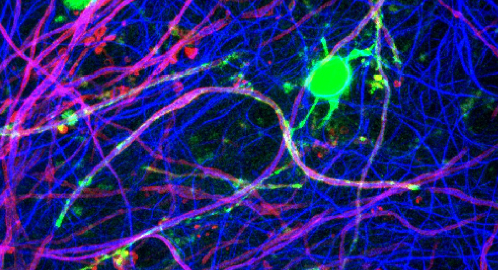 Neuroinflammation and Neurodegeneration